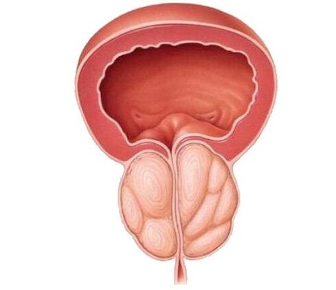 Aumento da próstata e tratamento con cápsulas de UroSaf